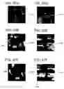 Fig. 33 - Hybrid segmentation of anatomical structure