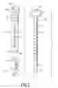 Fig. 03 - Self-drilling wall anchor device