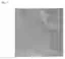 Fig. 02 - Agent for enhancing contrast of image of fluorescent staining of lumen of digestive tract