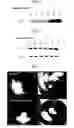 Fig. 02 - Polypeptide Inducing the Secretion of Angiopoietin