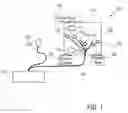 Fig. 02 - Device and method for screening congenital heart disease