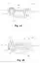Fig. 02 - Pivotable vetrebral spacer