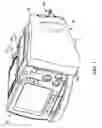 Fig. 02 - Electrode package attached to exterior of defibrillator