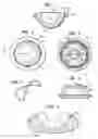 Fig. 02 - Flanged prosthetic acetabular cup