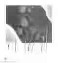 Fig. 02 - Method for processing a digital gray value image so that a reduced image noise and simultaneously a higher image sharpness is achieved