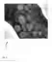 Fig. 05 - Method for processing a digital gray value image so that a reduced image noise and simultaneously a higher image sharpness is achieved