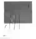 Fig. 06 - Method for processing a digital gray value image so that a reduced image noise and simultaneously a higher image sharpness is achieved