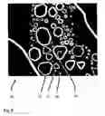 Fig. 09 - Method for processing a digital gray value image so that a reduced image noise and simultaneously a higher image sharpness is achieved