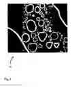 Fig. 10 - Method for processing a digital gray value image so that a reduced image noise and simultaneously a higher image sharpness is achieved