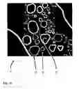 Fig. 11 - Method for processing a digital gray value image so that a reduced image noise and simultaneously a higher image sharpness is achieved