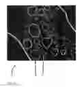 Fig. 12 - Method for processing a digital gray value image so that a reduced image noise and simultaneously a higher image sharpness is achieved
