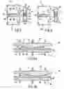 Fig. 02 - Spinal Arthroplasty System