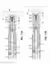 Fig. 09 - Mop assembly with fastener channels