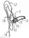Fig. 01 - In-ear earphone
