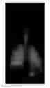 Fig. 01 - Methods for the delivery of a beta2 agonist to induce bronchodilation and formulations for use in the same