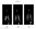 Fig. 04 - Methods for the delivery of a beta2 agonist to induce bronchodilation and formulations for use in the same