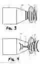Fig. 03 - Acoustic pressure wave applicator system with conduction pad