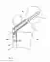 Fig. 10 - Bone fixation means