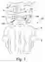 Fig. 02 - Minimal spacing spinal stabilization device and method