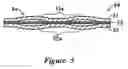 Fig. 06 - SEALING STRUCTURE USING METAL GASKET