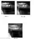 Fig. 09 - Stereo image and video directional mapping of offset