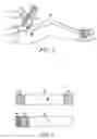 Fig. 05 - Radiographic cassette holding device