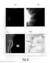 Fig. 08 - System and method for coronary digital subtraction angiography