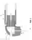 Fig. 05 - Contra-angle rotating handpiece having tactile-feedback tip ferrule