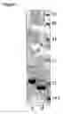 Fig. 02 - Method for Refolding Neisserial Nspa Protein