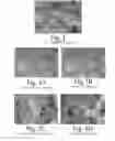 Fig. 02 - Biological fixative and method of using the biological fixative