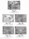 Fig. 06 - Biological fixative and method of using the biological fixative