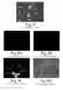 Fig. 09 - Biological fixative and method of using the biological fixative