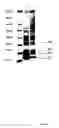 Fig. 08 - Production of HIV