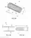 Fig. 03 - Soft tissue sock enhancement devices