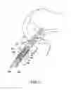 Fig. 04 - Soft tissue sock enhancement devices