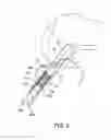 Fig. 06 - Soft tissue sock enhancement devices
