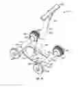 Fig. 16 - Soft tissue sock enhancement devices