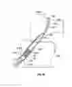 Fig. 28 - Soft tissue sock enhancement devices