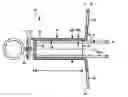Fig. 01 - Tracheostoma spacer, tracheotomy method, and device for inserting a tracheostoma spacer