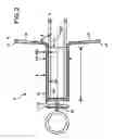 Fig. 03 - Tracheostoma spacer, tracheotomy method, and device for inserting a tracheostoma spacer