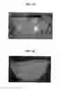 Fig. 05 - Fluorescence polarization imaging devices and methods