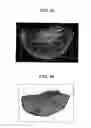 Fig. 06 - Fluorescence polarization imaging devices and methods