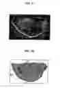 Fig. 07 - Fluorescence polarization imaging devices and methods