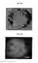 Fig. 10 - Fluorescence polarization imaging devices and methods