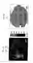 Fig. 11 - Fluorescence polarization imaging devices and methods