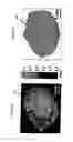 Fig. 12 - Fluorescence polarization imaging devices and methods