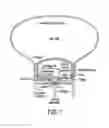 Fig. 08 - In Vivo Device with Balloon Stabilizer and Valve