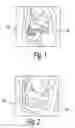 Fig. 02 - Tampon assembly providing proper bodily placement of a pledget