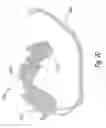 Fig. 22 - Tampon assembly providing proper bodily placement of a pledget