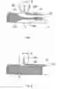 Fig. 02 - Methods and devices for reducing or blocking blood flow to a selected blood vessel or part thereof